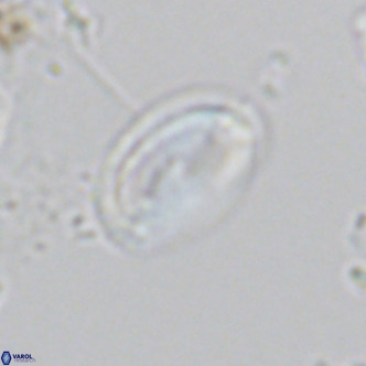 Helicosphaera wallichii VR 05173