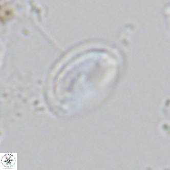 Helicosphaera wallichii VR 05173
