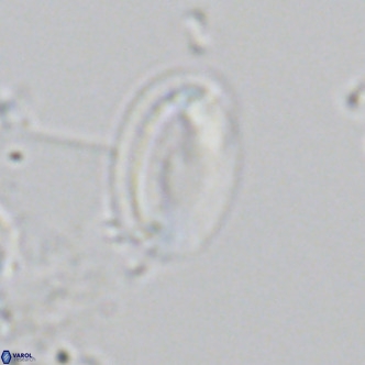 Helicosphaera wallichii VR 05174