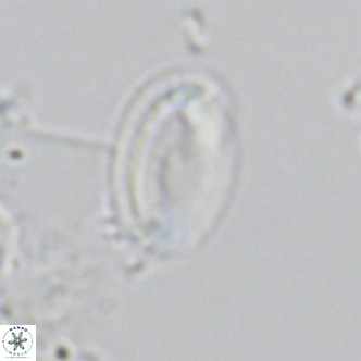 Helicosphaera wallichii VR 05174