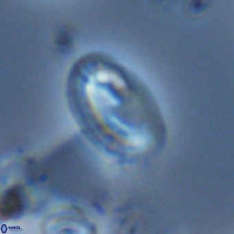 Helicosphaera wallichii VR 05178