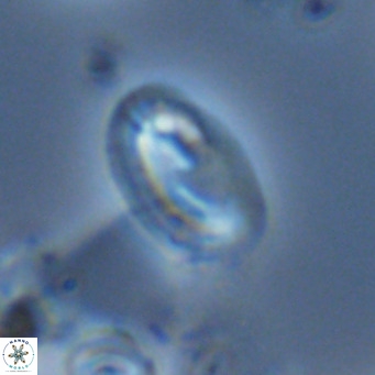 Helicosphaera wallichii VR 05178