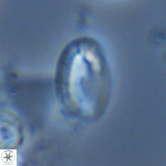 Helicosphaera wallichii VR 05179