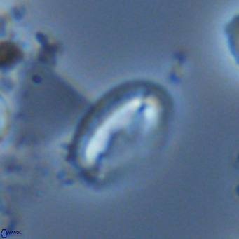 Helicosphaera wallichii VR 05180