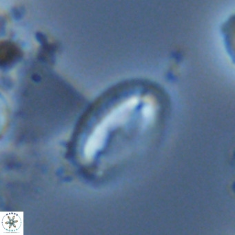 Helicosphaera wallichii VR 05180