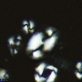 Helicosphaera wallichii VR 05353