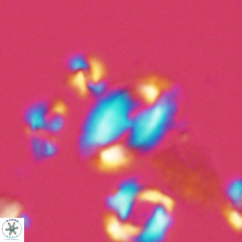 Helicosphaera wallichii VR 05354