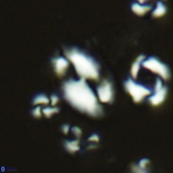 Helicosphaera wallichii VR 05356