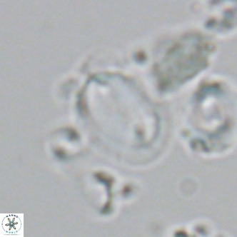 Helicosphaera wallichii VR 05357