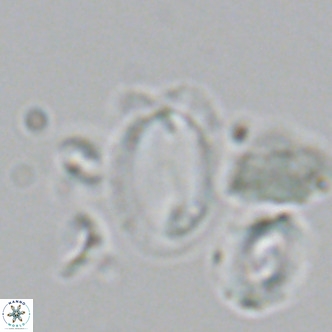 Helicosphaera wallichii VR 05358
