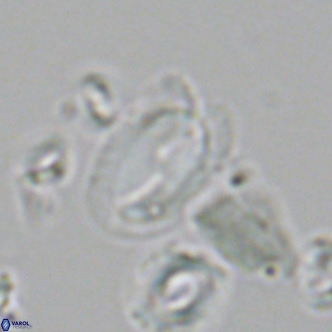 Helicosphaera wallichii VR 05359