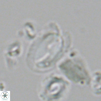 Helicosphaera wallichii VR 05359