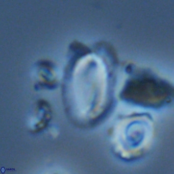 Helicosphaera wallichii VR 05361