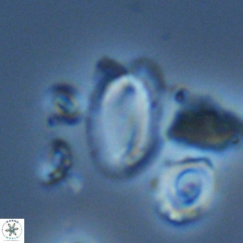 Helicosphaera wallichii VR 05361
