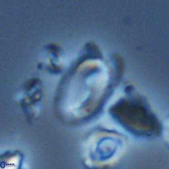 Helicosphaera wallichii VR 05363