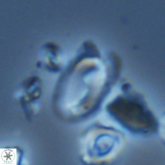 Helicosphaera wallichii VR 05363