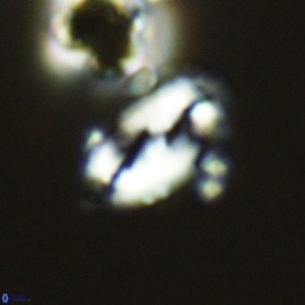 Helicosphaera wallichii VR 05411