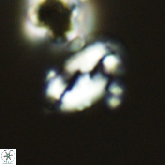 Helicosphaera wallichii VR 05411