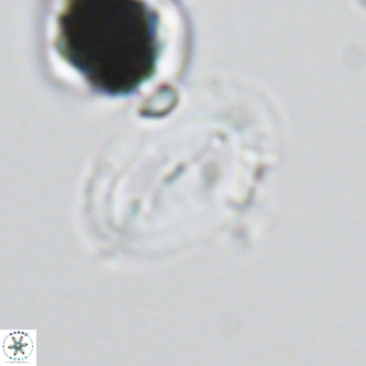 Helicosphaera wallichii VR 05412