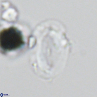 Helicosphaera wallichii VR 05414