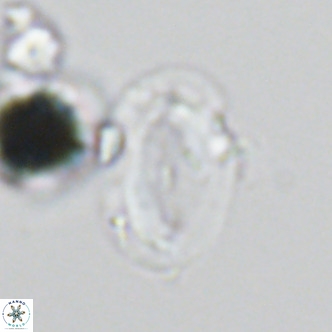 Helicosphaera wallichii VR 05414