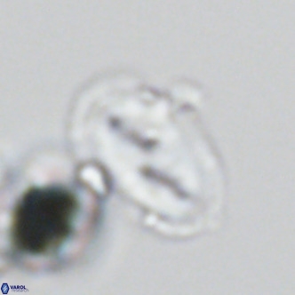 Helicosphaera wallichii VR 05416