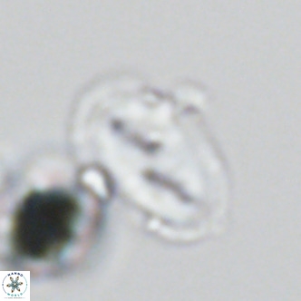 Helicosphaera wallichii VR 05416