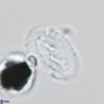 Helicosphaera wallichii VR 05418