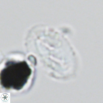Helicosphaera wallichii VR 05418
