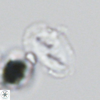 Helicosphaera wallichii VR 05419