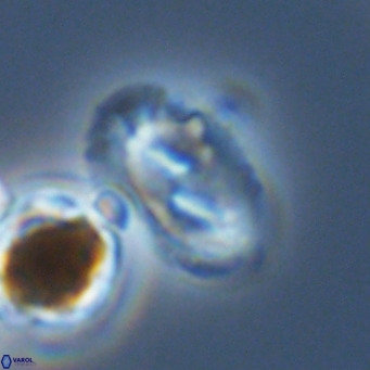 Helicosphaera wallichii VR 05420