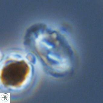 Helicosphaera wallichii VR 05420