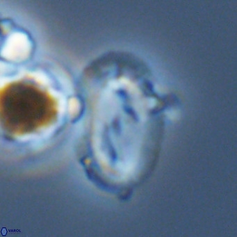 Helicosphaera wallichii VR 05421