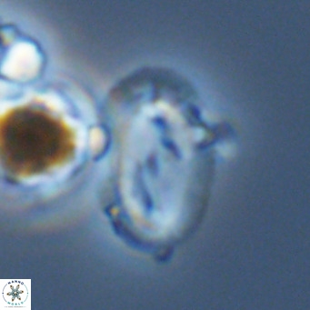 Helicosphaera wallichii VR 05421