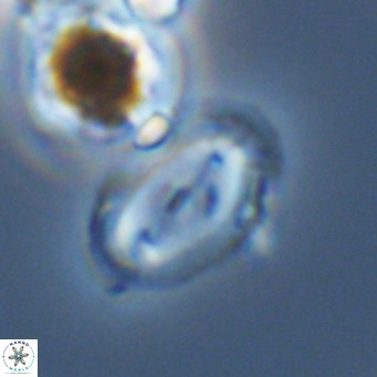 Helicosphaera wallichii VR 05422