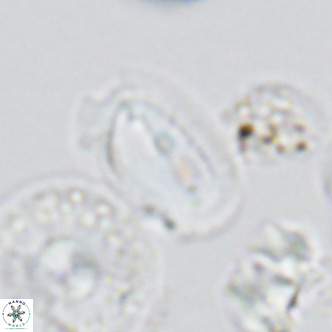 Helicosphaera wallichii VR 05680