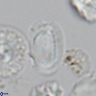 Helicosphaera wallichii VR 05681