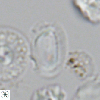 Helicosphaera wallichii VR 05681
