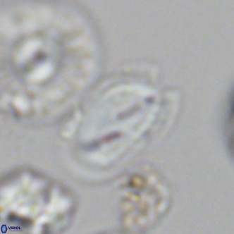 Helicosphaera wallichii VR 05682