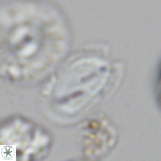 Helicosphaera wallichii VR 05682