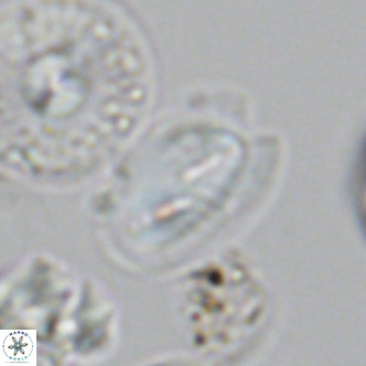 Helicosphaera wallichii VR 05683