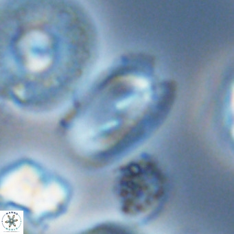 Helicosphaera wallichii VR 05684