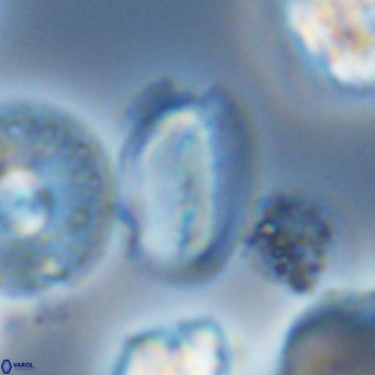 Helicosphaera wallichii VR 05685