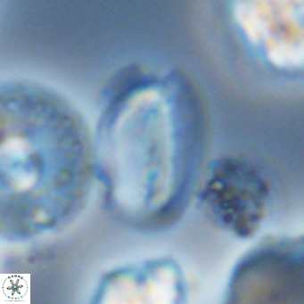 Helicosphaera wallichii VR 05685