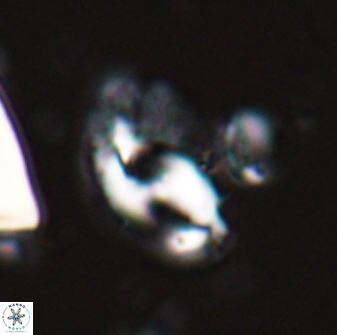 Helicosphaera waltrans 27589
