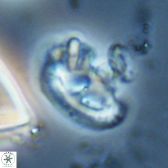 Helicosphaera waltrans 27595