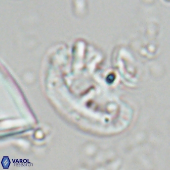 Helicosphaera waltrans 27596