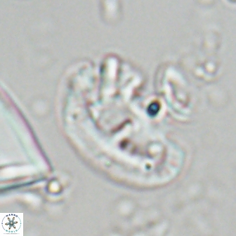 Helicosphaera waltrans 27596