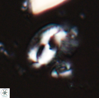 Helicosphaera waltrans 27590