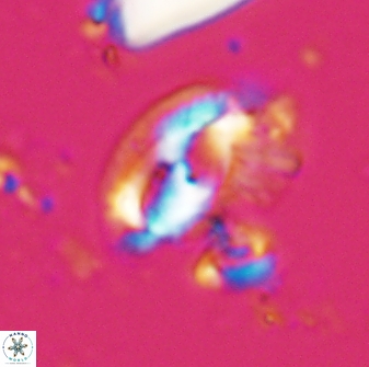 Helicosphaera waltrans 27592